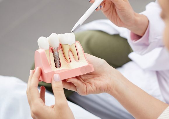 Prótesis dental